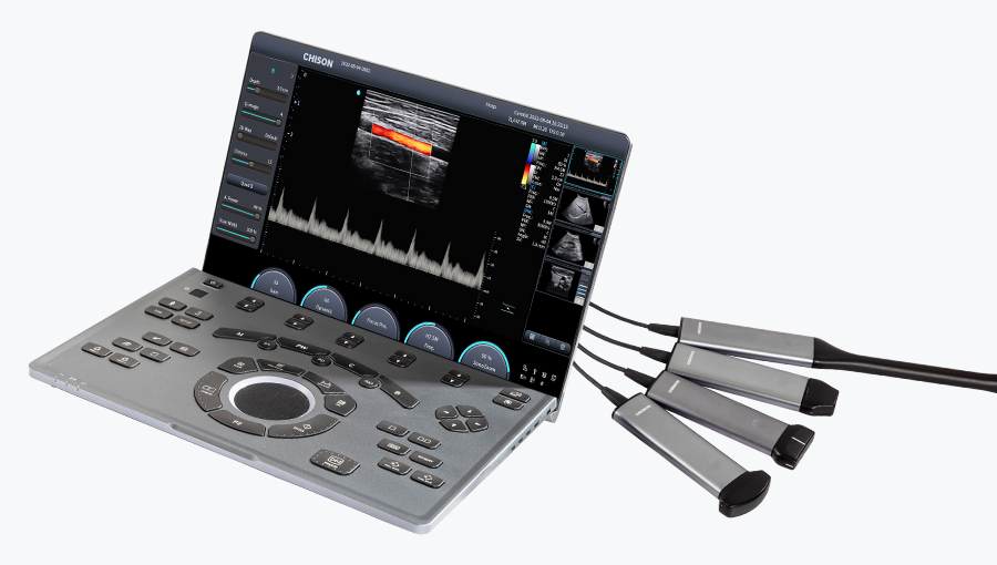 Tecnologie per Ultrasonologia